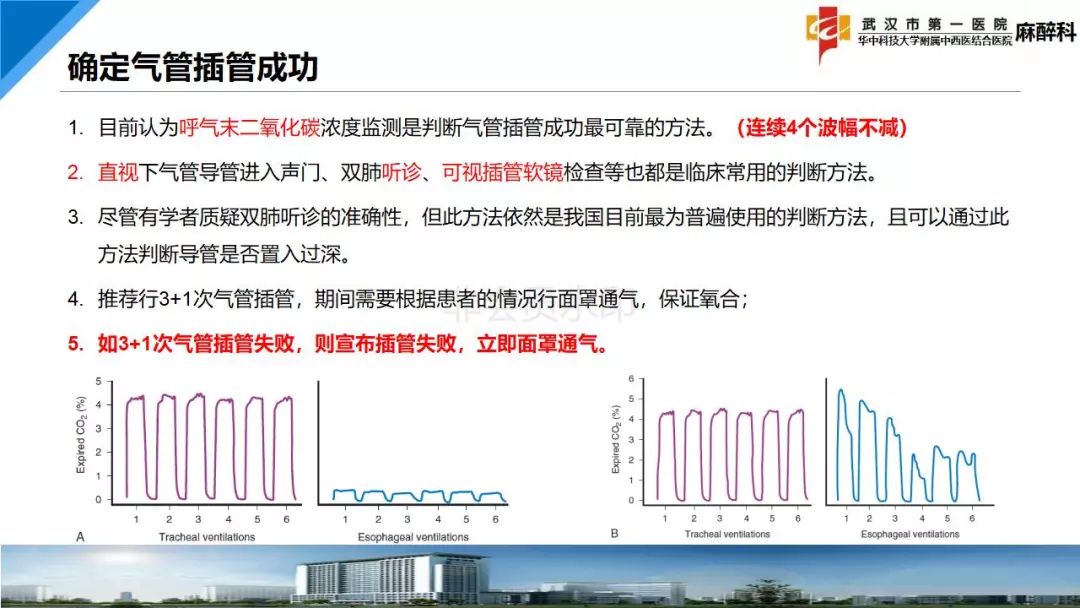 最新版气道管理指南,业界翘首以盼的全新版气道管理指南正式发布。