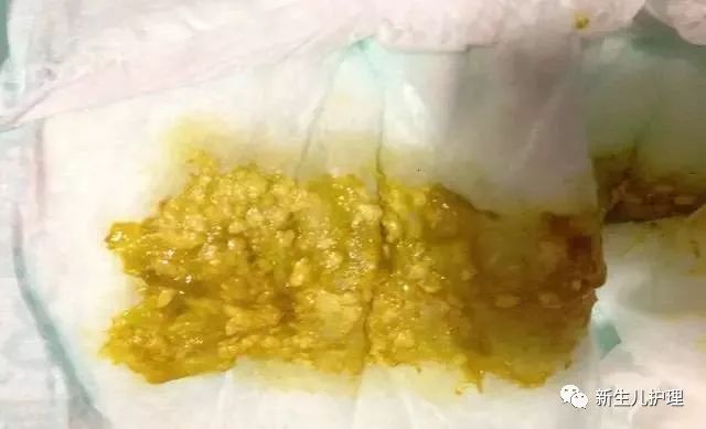 澳门一码一肖100准吗,全答解略答计_便版卓I69.124