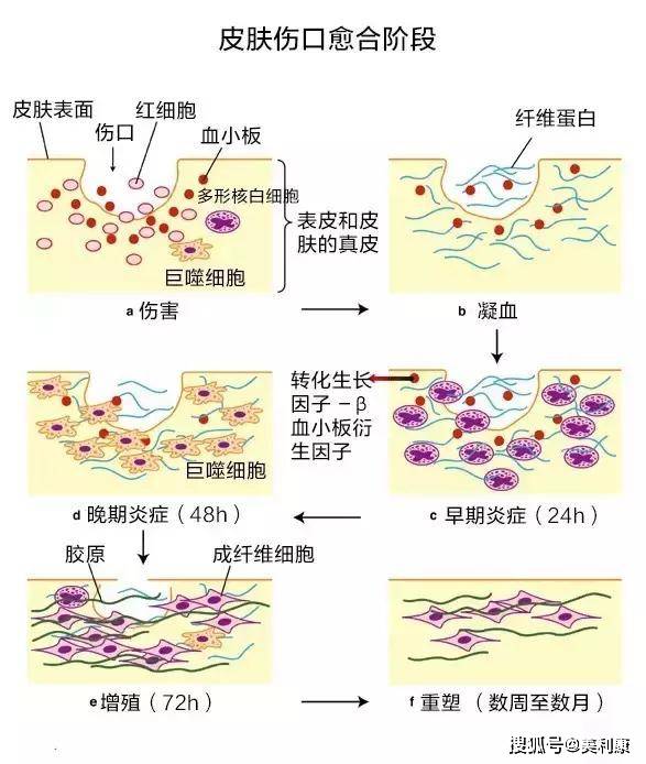 揭秘最新伤口护理学：探索现代医学中伤口愈合的科学与实践新境界